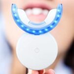 At-Home Blue Light Teeth Whitening Kit